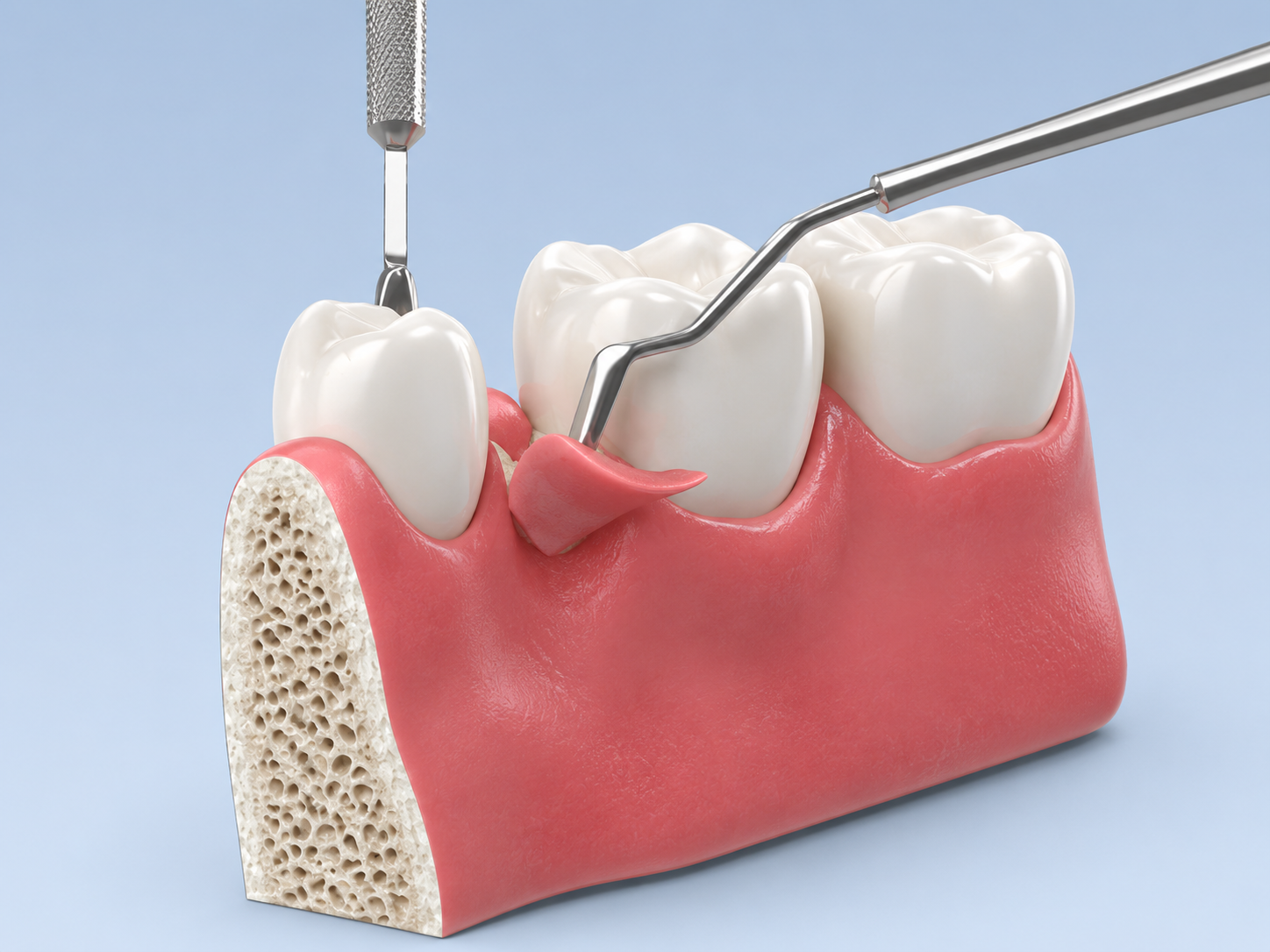 Костная пластинка